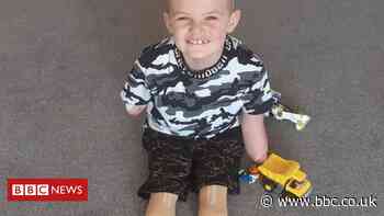 Luke Mortimer: Skipton boy who lost limbs to meningitis back home