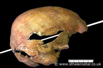 Medieval arrows caused similar injuries to gunshots, say archeologists - St Helens Star