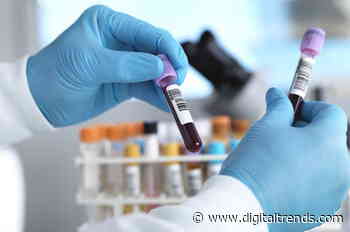 Coronavirus antibody tests aren’t created equal. Here’s what you need to know