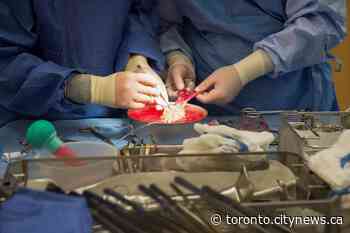 Ontario unveils framework to allow hospitals to resume elective surgeries - CityNews Toronto