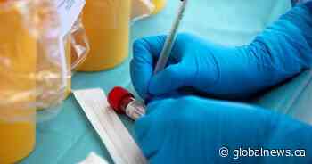 Ottawa Public Health reports 31 new coronavirus cases, 11 more deaths - Global News