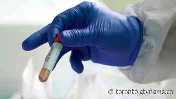 Tracking Ontario's 19,944 cases of COVID-19