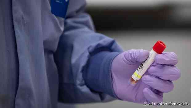 1 death and 59 new COVID-19 cases reported in Alberta on Saturday