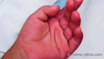 Potential link between coronavirus and inflammatory syndrome in children