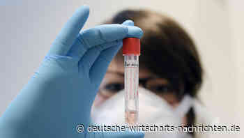 Top-Mediziner meint: „Dieses Virus ist nicht so ansteckend, wie manche annehmen“