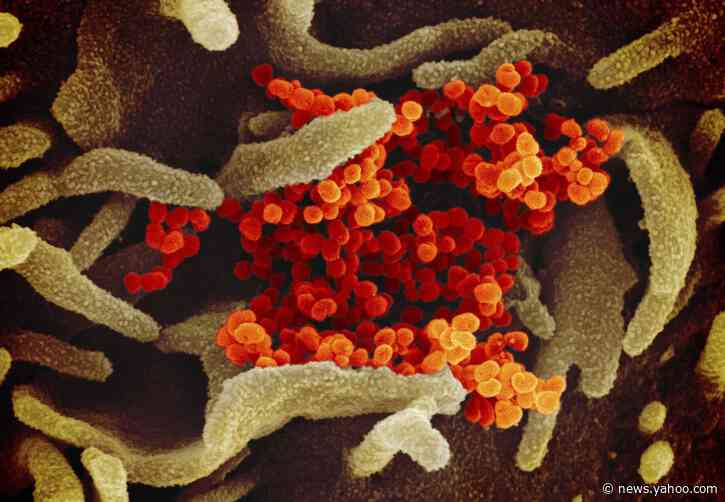 New coronavirus test is imperfect step toward mass screening