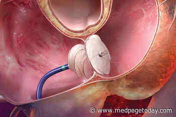 Residual Shunt Size Matters After PFO Closure