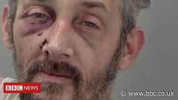 Leominster man jailed for punching on-duty paramedic