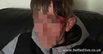North Belfast teenager badly injured after vicious group attack - Belfast Live
