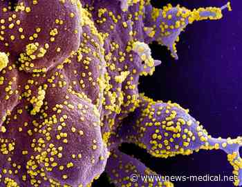 Study shows COVID-19 vulnerability is highly dependent on host genetic architecture - News-Medical.Net