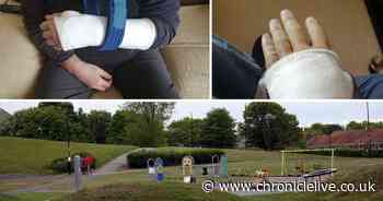 Dog walker feared for his life after stranger attacked him and broke his arm