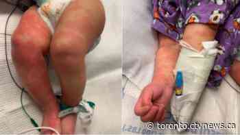 Ontario taking 'immediate action' after uptick in mysterious illness in kids that could be linked to COVID-19