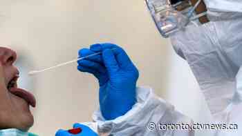 Ontario's number of new COVID-19 cases remains relatively static with 329 more patients