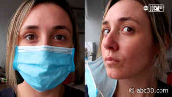 Coronavirus pandemic causing new skin issue: 'Mask-Ne' aka Mask Acne