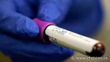 Doctors find possible link between COVID-19 and rare, potentially deadly illness in children