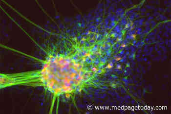Cell Therapy Shows Promise in Parkinson’s