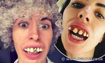 Ronnie Wood's wife Sally wears wig and false teeth for video