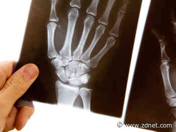 A majority of Australian public pathology labs now uploading results to My Health Record