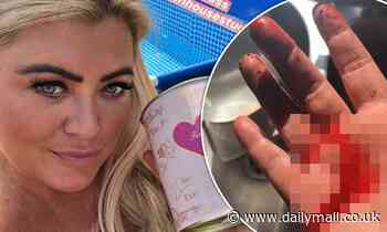 Gemma Collins' hand is covered in blood as she slices her finger open while attempting lockdown DIY