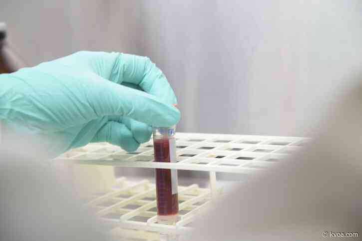 University of Arizona and the state are expanding COVID-19 antibody testing statewide