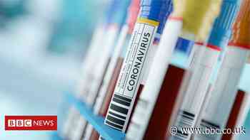 Coronavirus: Fall in weekly NI care home deaths