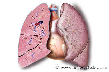 COVID-19 Pulmonary Embolism Often Seen Outside the ICU