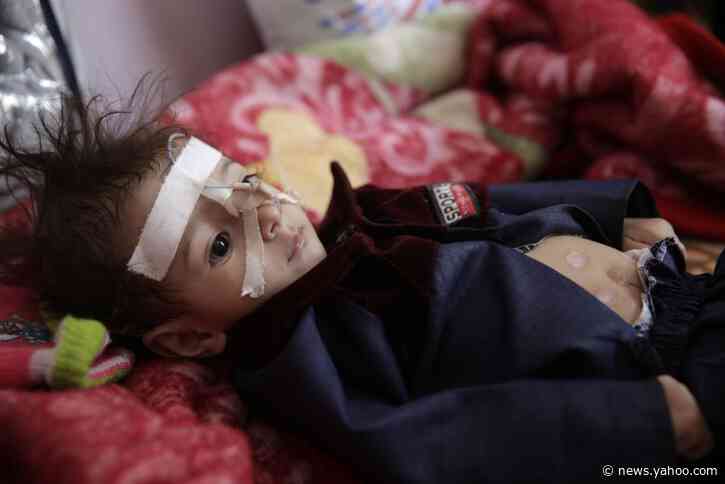 UN reports Yemen cease-fire progress, COVID-19 cases rising