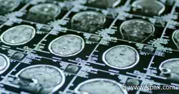 New medical evidence links coronavirus and strokes - KPAX-TV