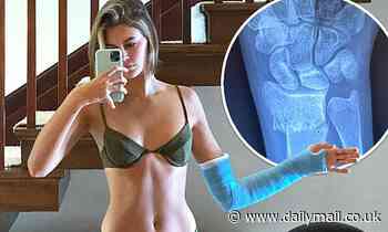 Kaia Gerber posts swimsuit snap with CAST as she reveals she dislocated wrist but says 'I'm okay!'