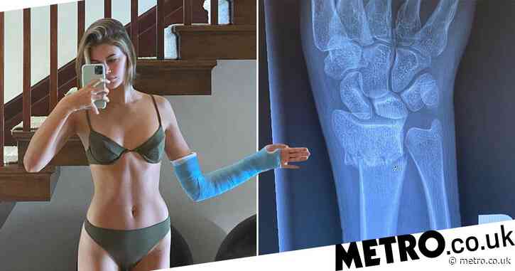 Kaia Gerber reveals broken arm in lockdown: ‘Had a little accident but I’m okay!’