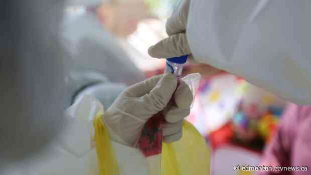 Alberta confirms 72 new cases of COVID-19, 1 more death on Saturday