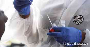 Alberta records 57 new COVID-19 cases Sunday, 1 additional death