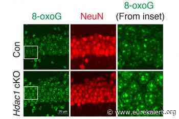 Study finds that aging neurons accumulate DNA damage