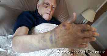 Pensioner's shocking injuries after thug attacked him in his own garden