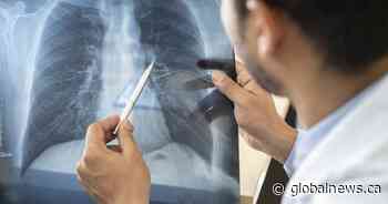 Alberta confirms 39 new COVID-19 cases Monday, 1 more death