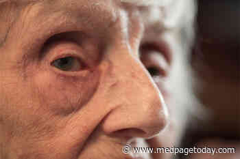 Can Cardio Risk Scores Predict Cognitive Decline?