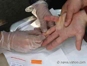 STD rates appear to be quietly skyrocketing across the US, as fewer people get tested and treated during the pandemic