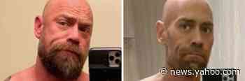 Nurse Shares COVID-19 Before-and-After Photos to Prove It's Not Just the 'Sick and Elderly' at Risk
