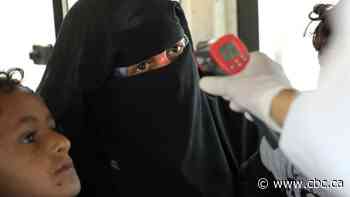 Yemen's health system 'has in effect collapsed' as coronavirus spreads, UN says