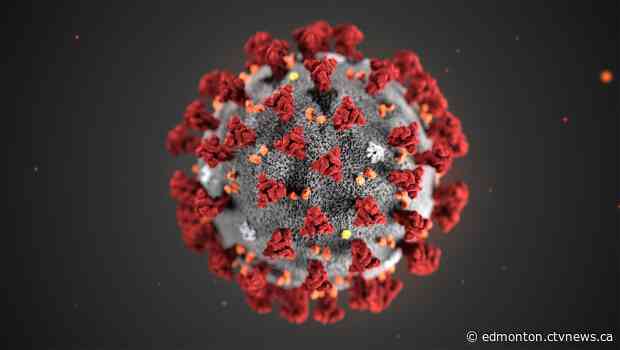 Alberta reports two COVID-19 deaths, 32 cases