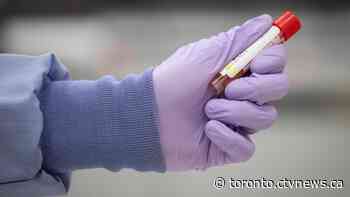 Ontario records more than 400 new cases of COVID-19 for third straight day