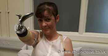 Major campaign to get woman bionic arms after she lost limbs through sepsis
