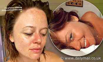 Emily Atack showcases her natural freckles as she goes make-up free in a series of sultry snaps