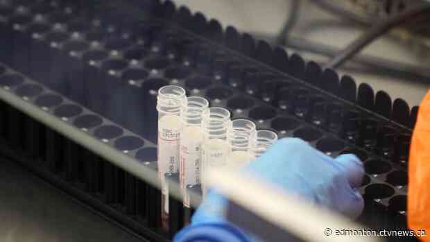 COVID-19 cases in Alberta remain low, 42 more cases reported Sunday