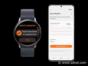 Samsung's ECG monitoring app approved by Korean regulator
