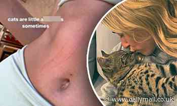 Hailey Bieber shows off scratch marks from one of her cats: 'Cats are little a******s sometimes'