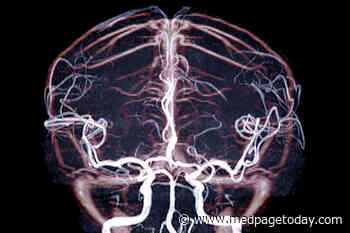 Asymptomatic Intracranial Stenosis: No Cause for Alarm