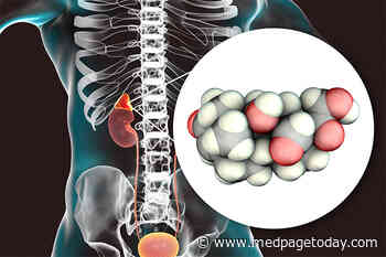 Hypertension Closely Tied to Aldosterone Levels