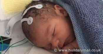 Baby given cannabis-linked drug to combat dangerous brain issue