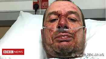 Injured cyclist 'deliberately' struck in York hit-and-run